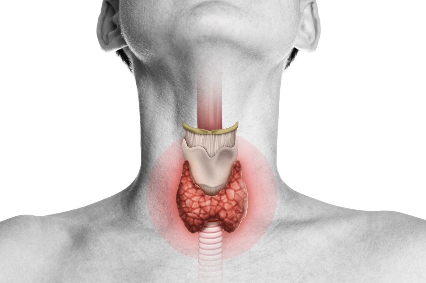 hypothyroidism awareness campaign