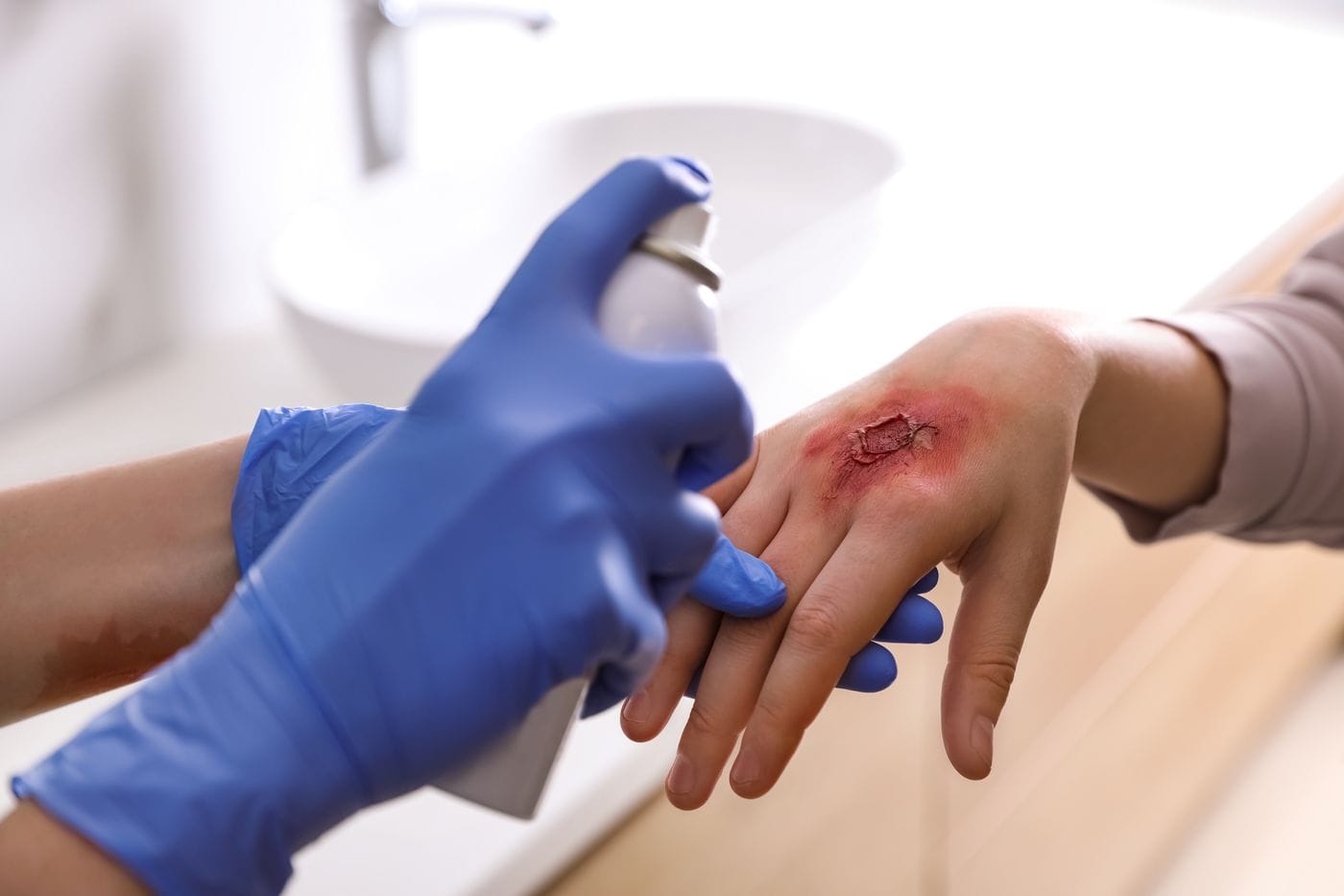 AGCL hemostatic spray powder developed by KAIST researchers
