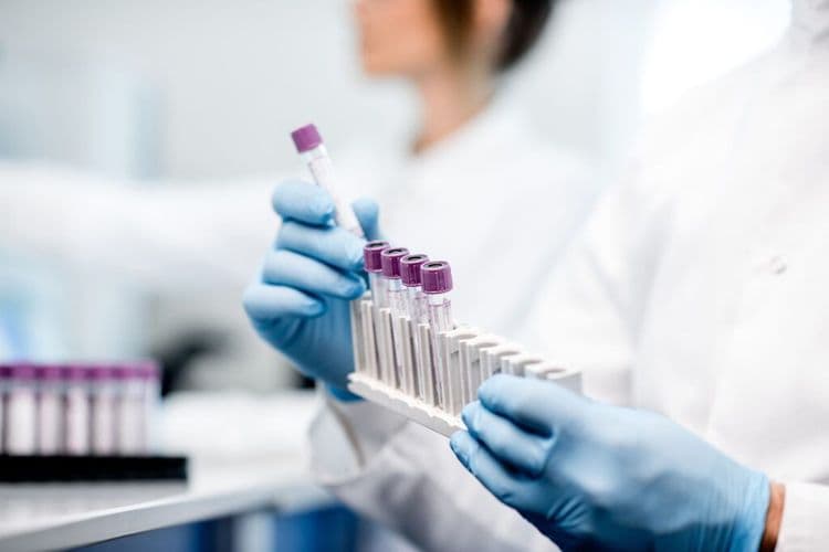 Groundbreaking AI Powered Cancer Blood Test