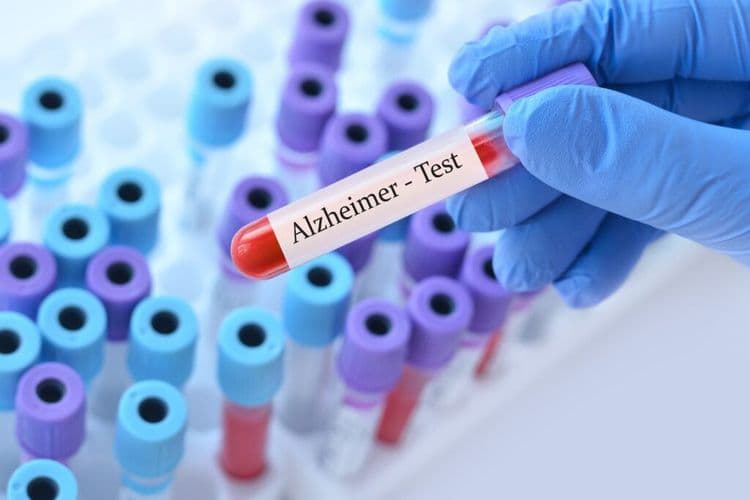 This Simple Blood Test Could Spot Alzheimer’s 16 Years Early