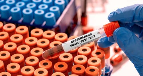 95% Of People Carry This Virus For Life And Scientists Just Found A Way To Stop It