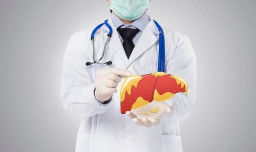 UCLA Scientists Just Found A Way To Reverse Fatty Liver Disease Without Changing Diet