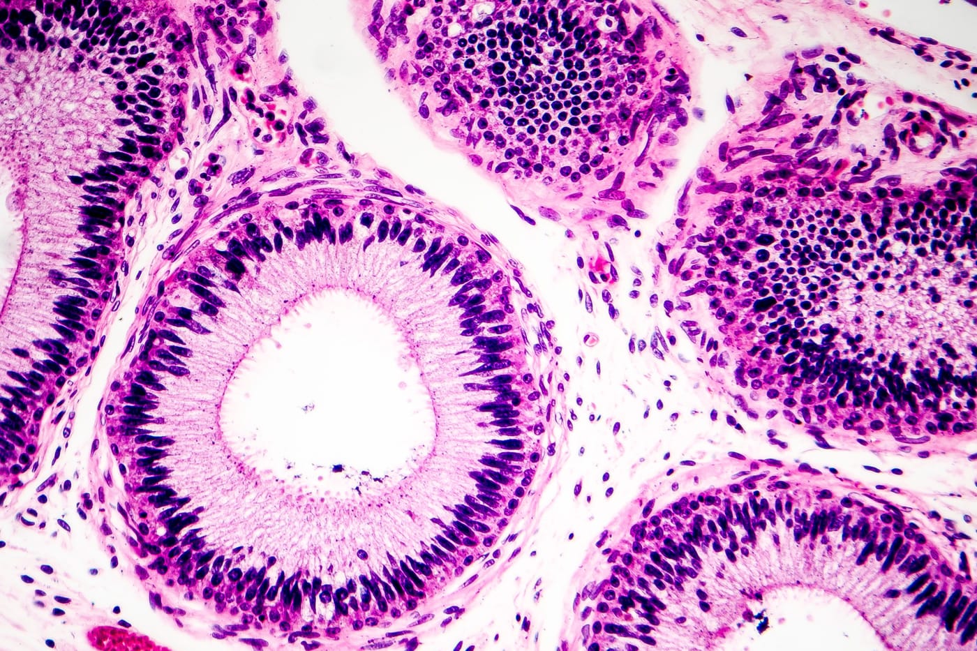 Life Biosciences partial reprogramming gene therapy cellular aging first human clinical trial glaucoma 2026